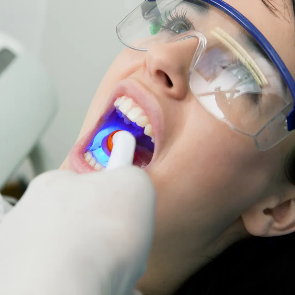 Dental sealants