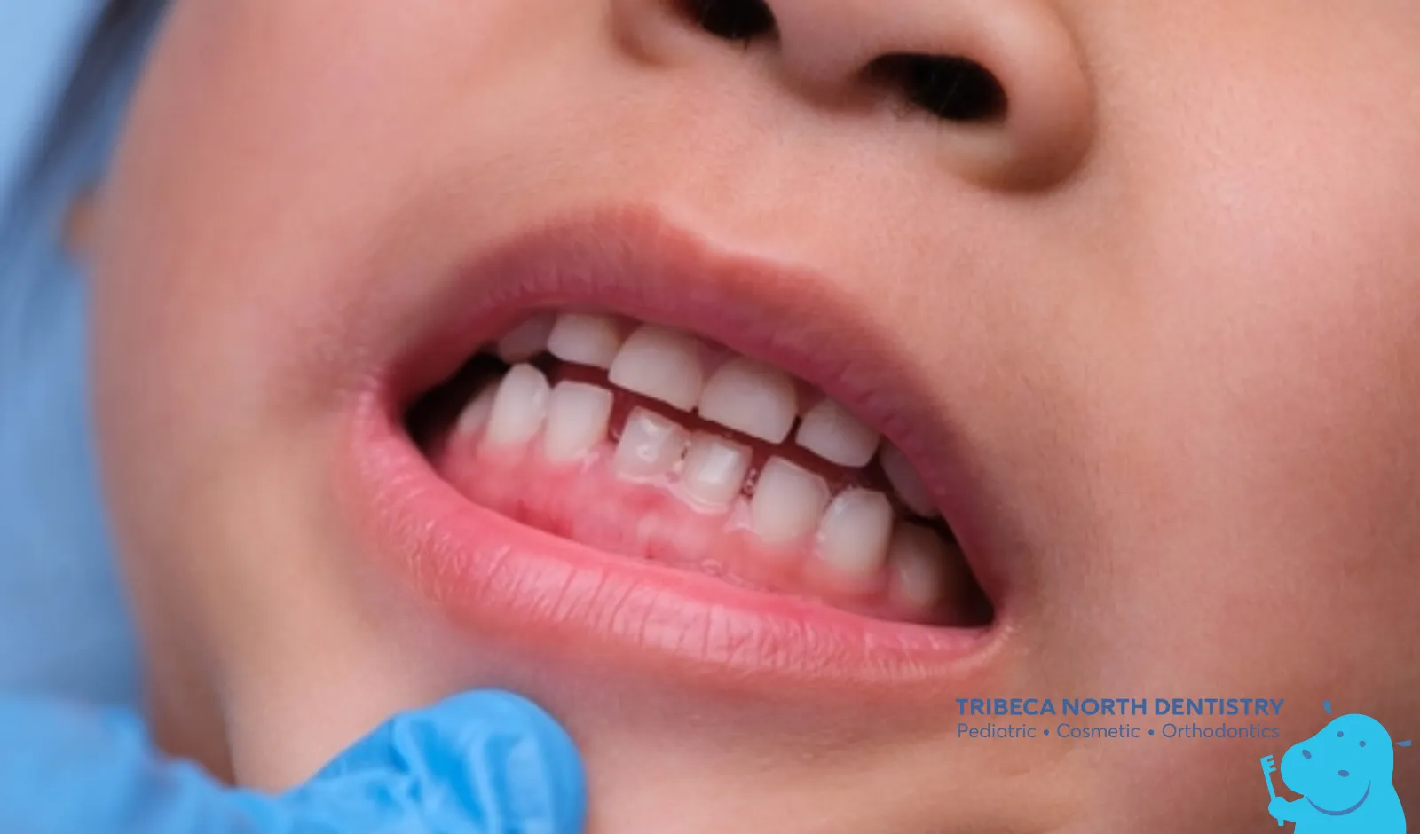 Common Causes of Toothaches in Children