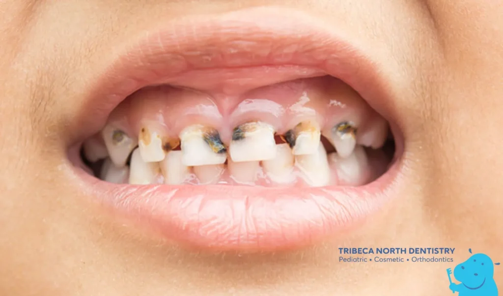 Common Causes of Toothaches in Children