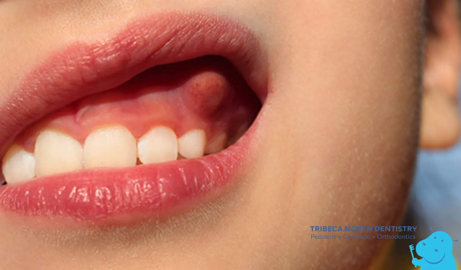 When to See a Dentist