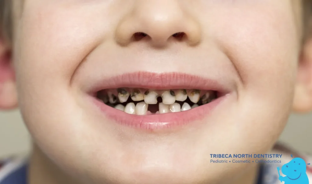 Why Kids Experience Tooth Pain