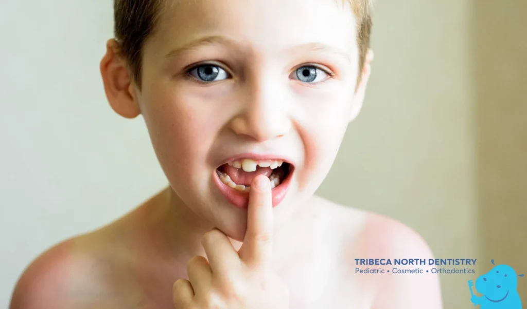 Cracked or Broken Tooth