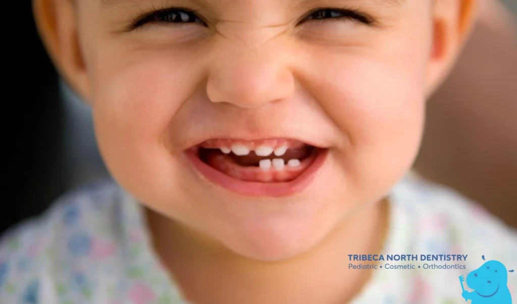 How Baby Teeth Affect Adult Teeth Development
