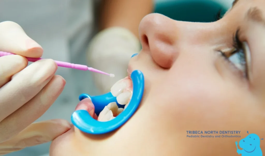 The Sealant Application Process