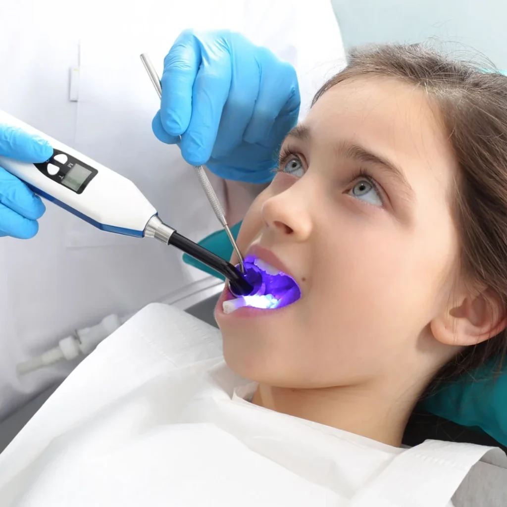 What Are Dental Sealants for Kids