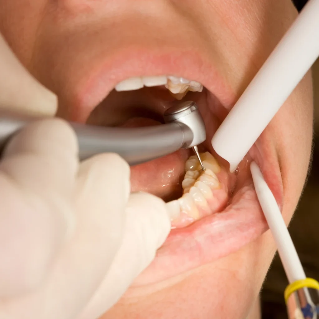 What to Expect During Treatment