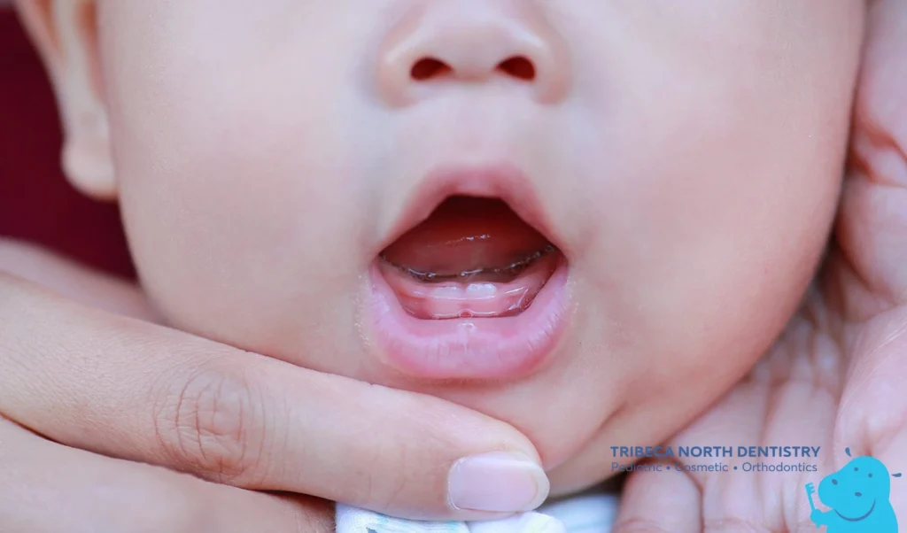 Teething Symptoms Parents Should Watch For