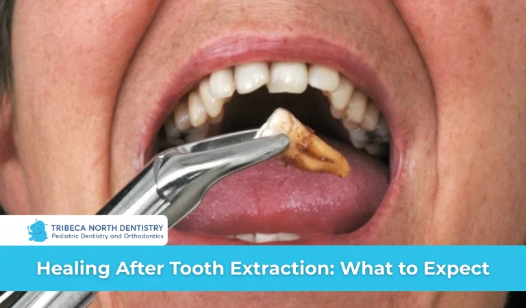 Healing After Tooth Extraction What to Expect