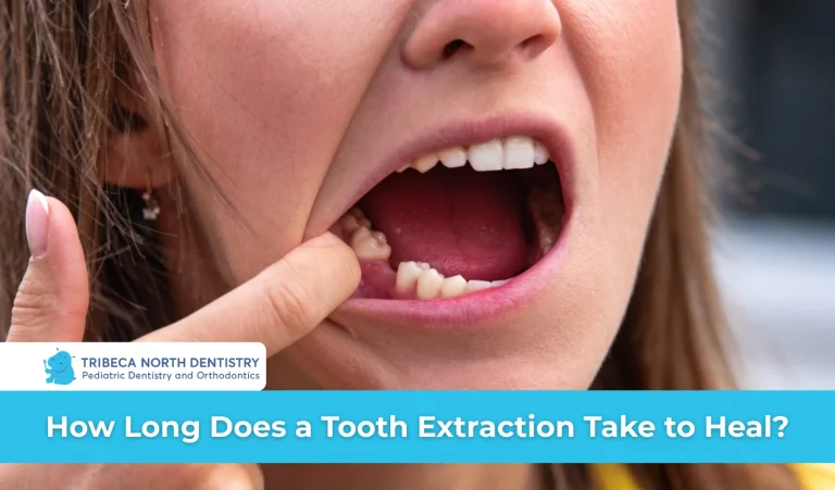 How Long Does a Tooth Extraction Take to Heal