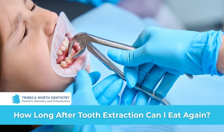 How Long After Tooth Extraction Can I Eat Again