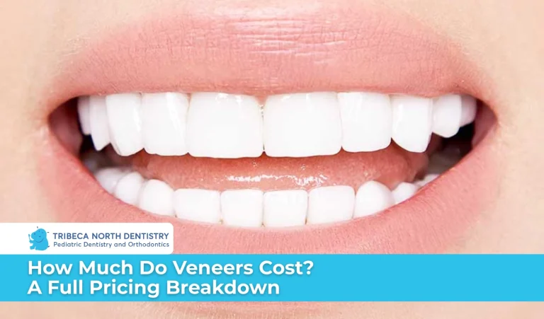 How Much Do Veneers Cost A Full Pricing Breakdown