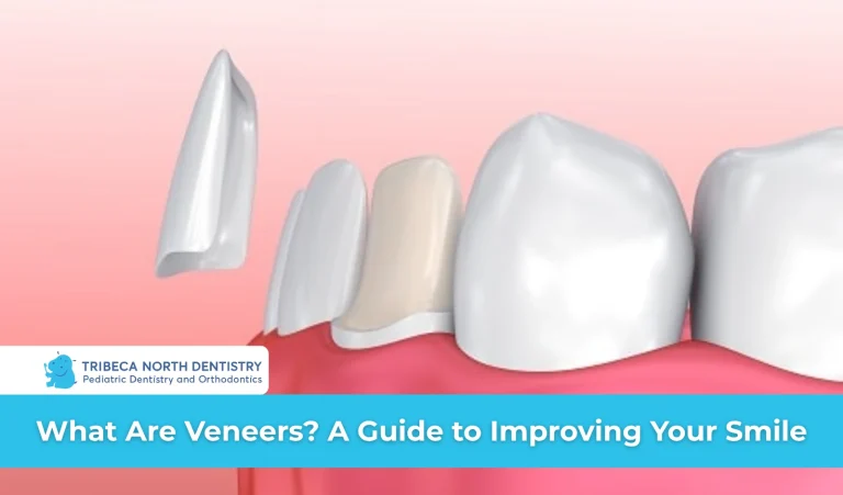 What Are Veneers A Guide to Improving Your Smile