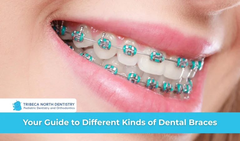 Your Guide to Different Kinds of Dental Braces
