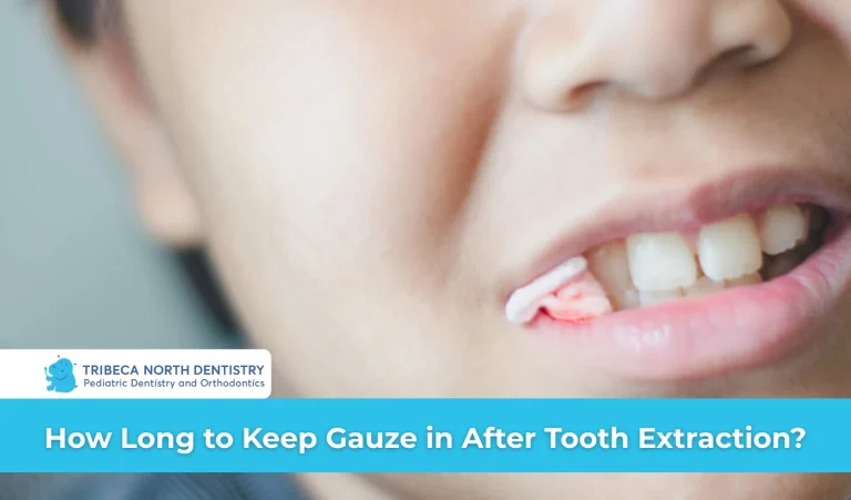 How Long to Keep Gauze in After Tooth Extraction