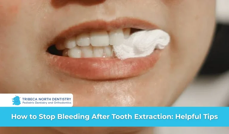How to Stop Bleeding After Tooth Extraction: Helpful Tips