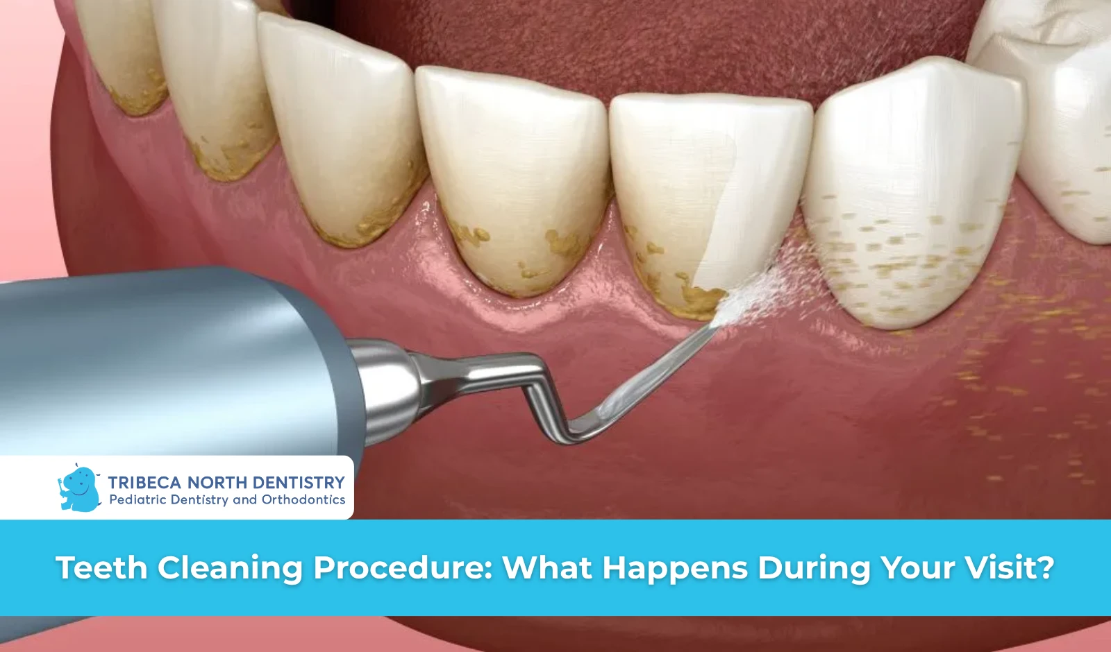 Teeth Cleaning Procedure What Happens During Your Visit