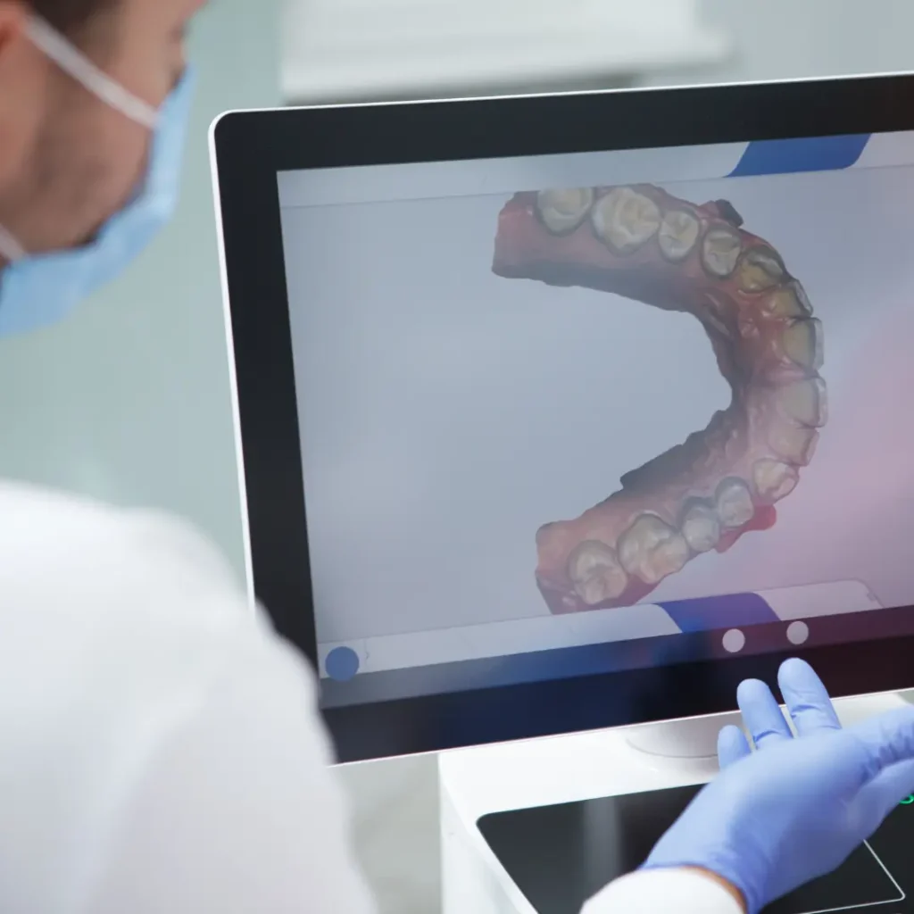 3D Digital Scan