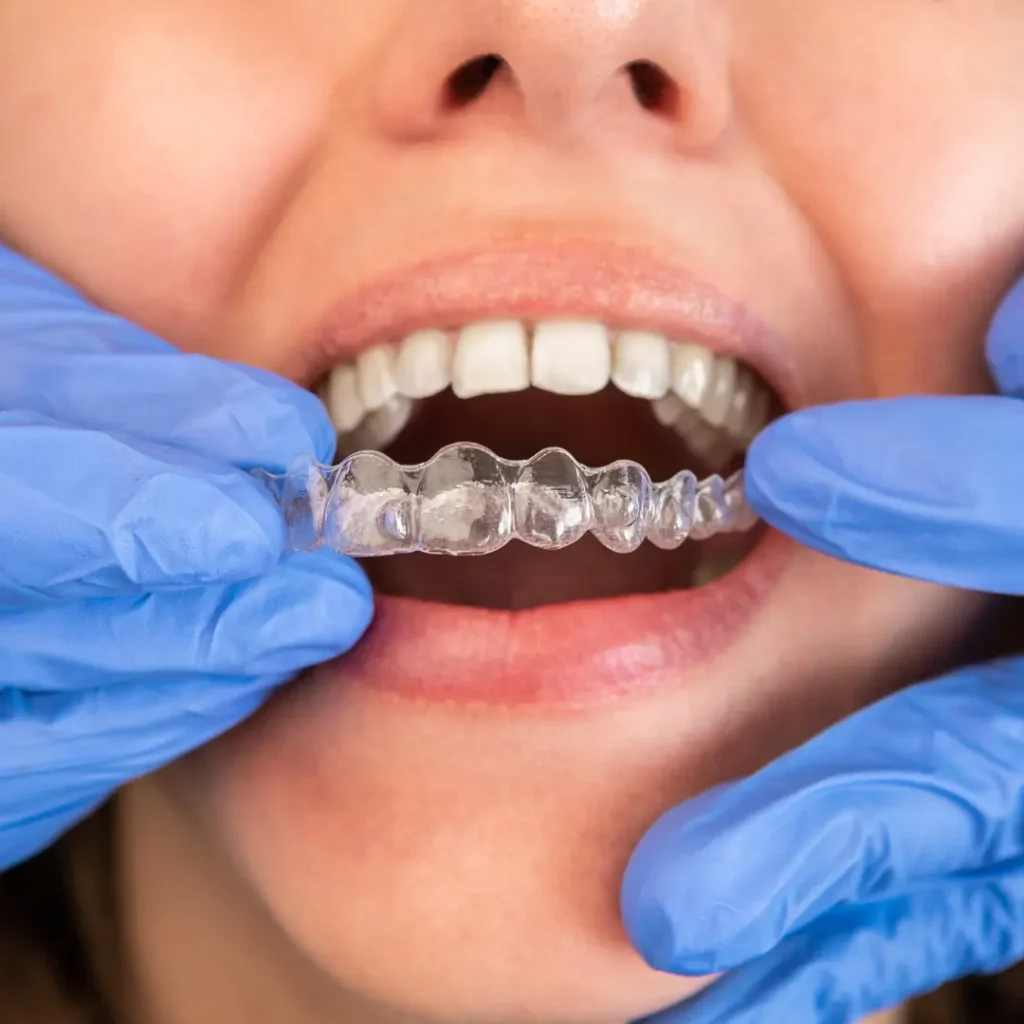 Orthodontic Exam